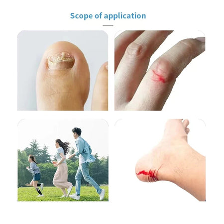 H-Type Wound Bandage &ndash; Waterproof Emergency Plaster Patch