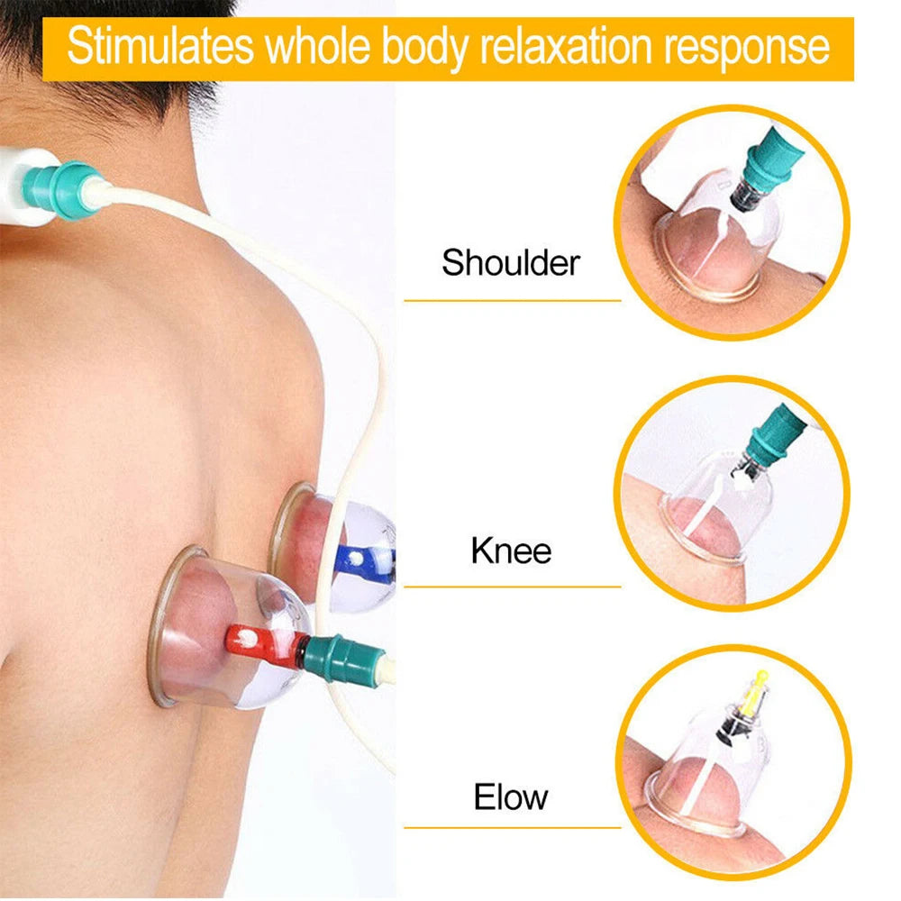 Cupping Massage Cups Therapy Set &ndash; Effective Pain Relief Therapy