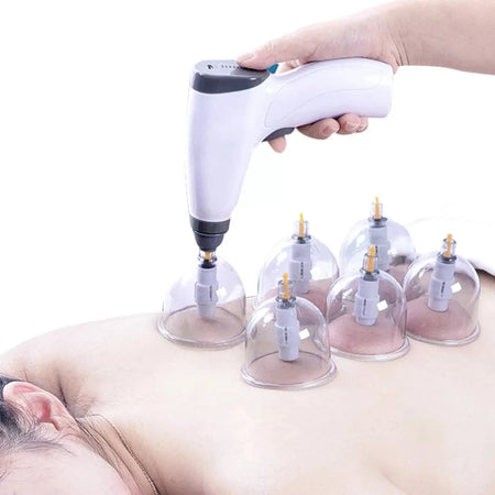 Suction Cup AntiCellulite Cupping Massage Set &ndash; Compact And Powerful