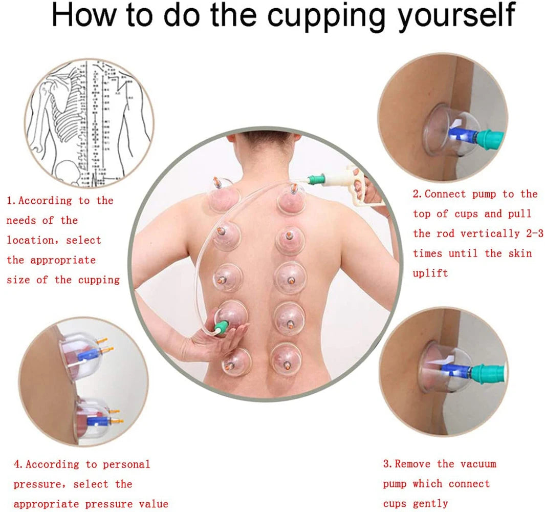 Cupping Massage Cups Therapy Set &ndash; Effective Pain Relief Therapy