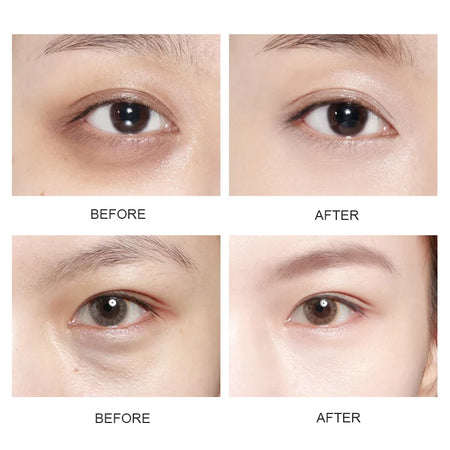 SERSANLOVE Gold Collagen Eye Patches for Dark Circles and Anti-Aging