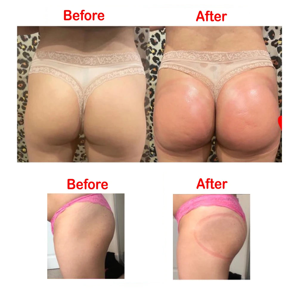 2Pcs Buttock Vacuum Sucker Cups 21Cm 180Ml &ndash; Large Capacity