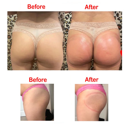 2Pcs Buttock Vacuum Sucker Cups 21Cm 180Ml &ndash; Large Capacity