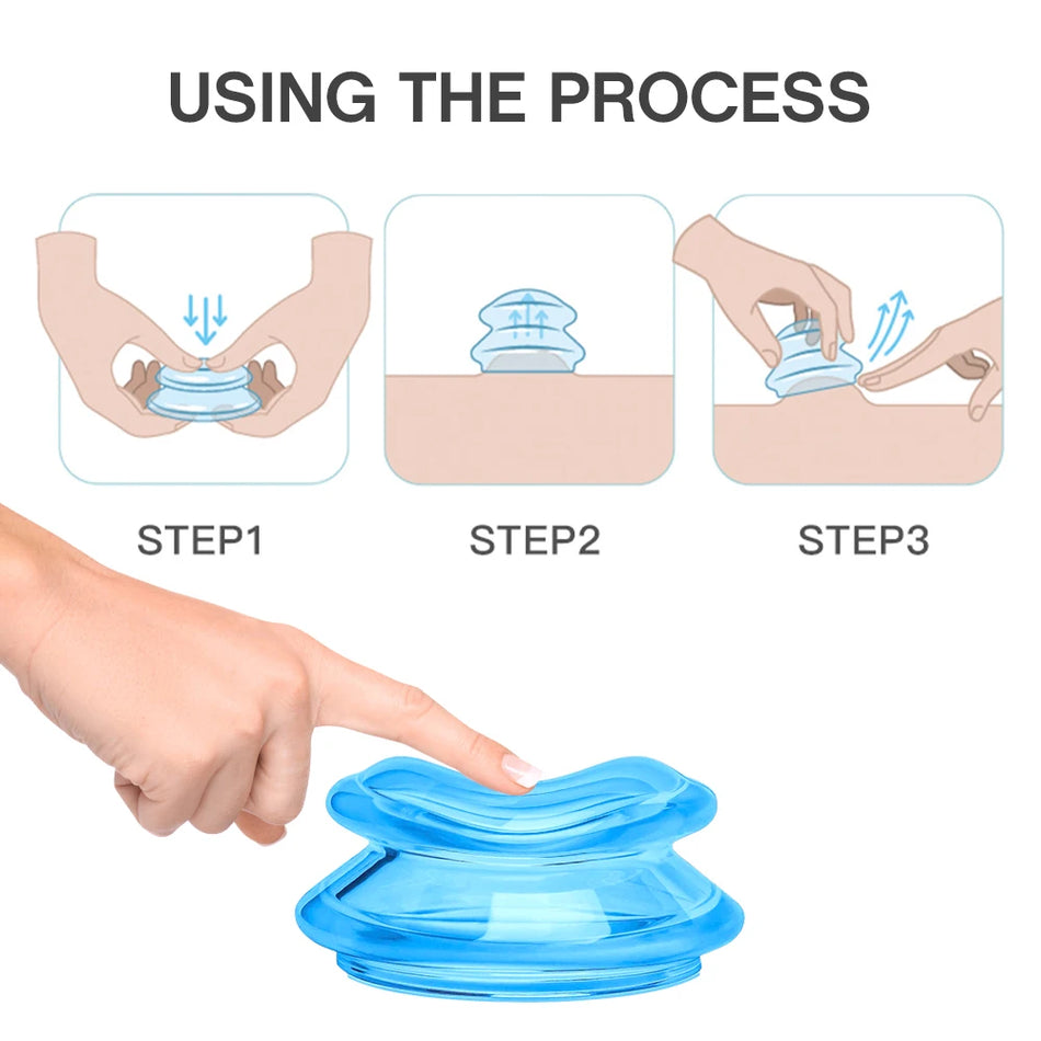Silicone Massage Cups &ndash; Vacuum Cupping Therapy Deep Tissue
