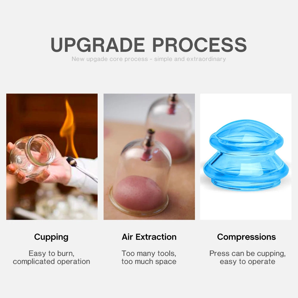 Silicone Massage Cups &ndash; Vacuum Cupping Therapy Deep Tissue