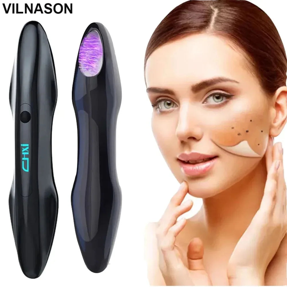 Ozone Cold Plasma Beauty Pen &ndash; Acne Removal Deep Cleaning