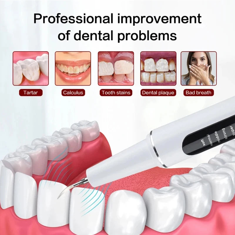 Xiaomi Youpin Ultrasonic Dental Scaler &ndash; High Frequency