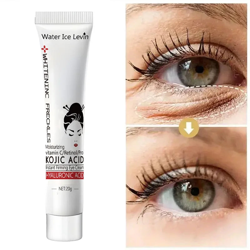 Kojic Acid Eye Cream &ndash; Anti-Dark Circles and Puffiness