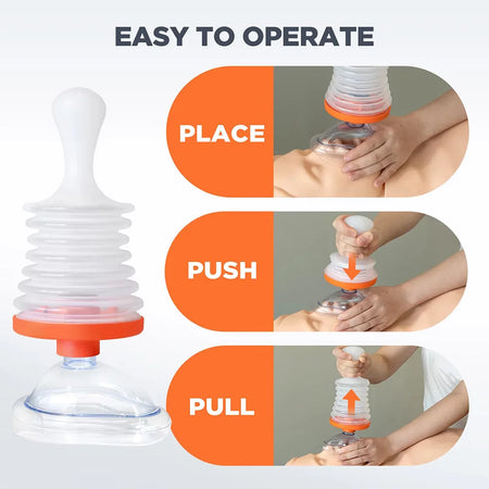 Portable Anti Choking Device &ndash; Emergency Airway Assist