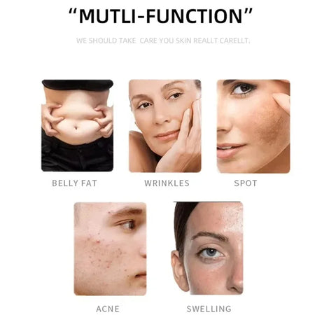 Brands Mini 1MHz Ultrasonic Slimming Massager &ndash; Noninvasive