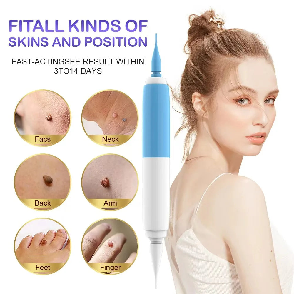 2-In-1 Skin Tag Wart Removal Kit - Painless Auto Removal
