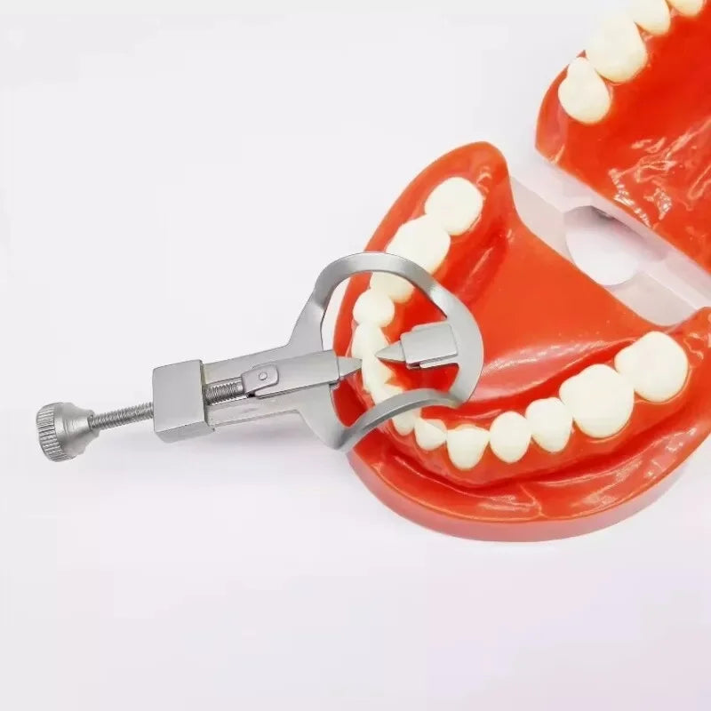 Dental Tooth Separator Wedges &ndash; Superior Precision for Orthodontic Procedures