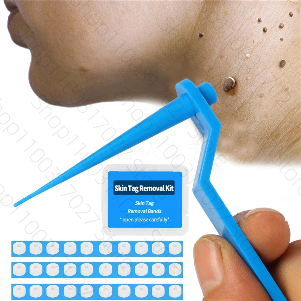 30pcs Skin Tag Remover Rubber Rings - Non-Toxic &amp; Painless Wart Removal