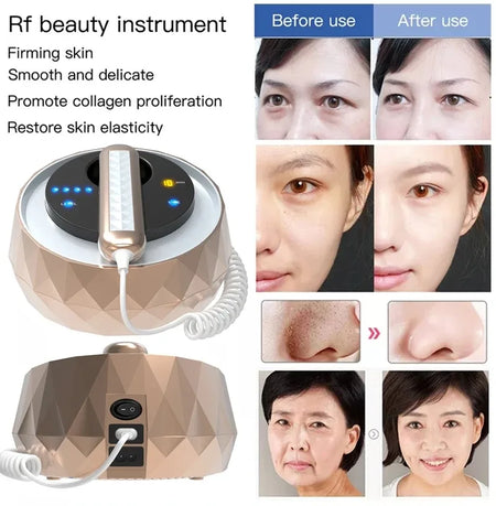 3 In 1 RF Beauty Machine Facial And Body - Skin Tightening