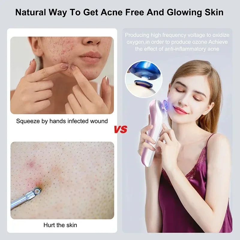 Plasma Facial Massager &ndash; Blue Light Ozone Therapy Device