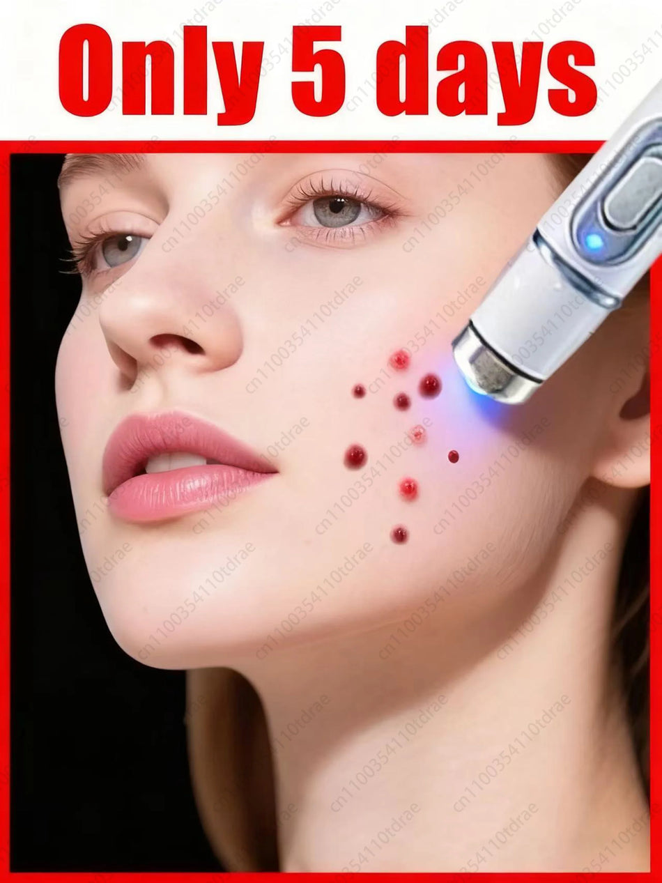 Kotikäyttöinen syylänpoistolaastari jaloille, hellävarainen, nopea 7 päivän tulokset