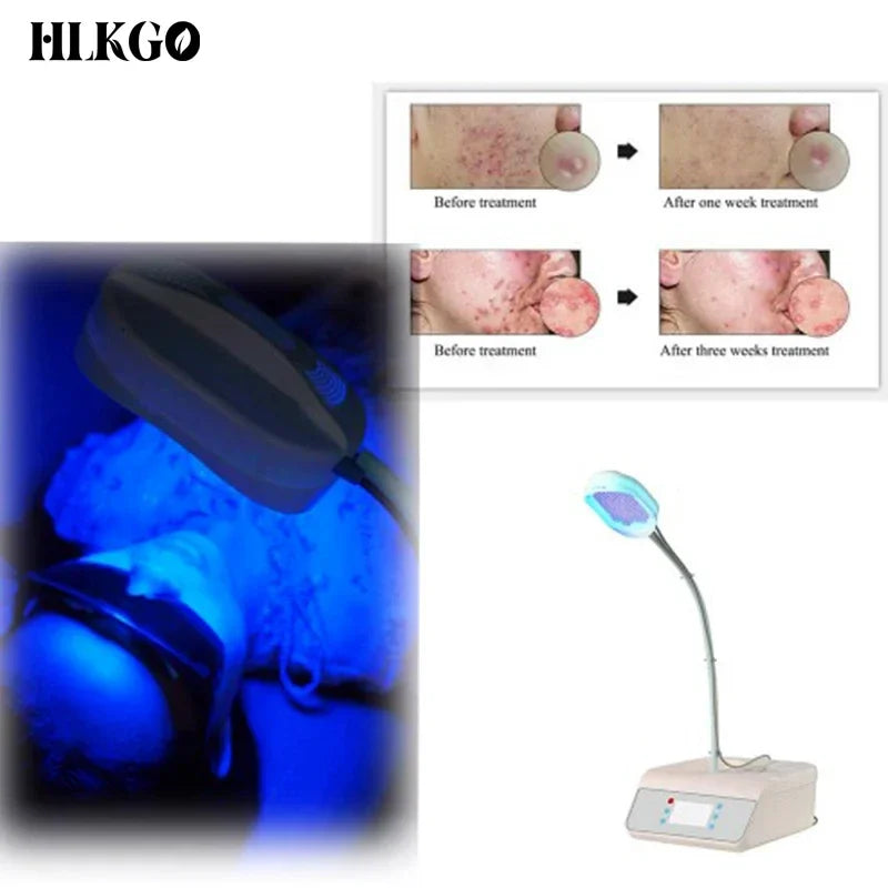 LED fotonová terapie obličejová maska 2 barvy pro akné vrásky