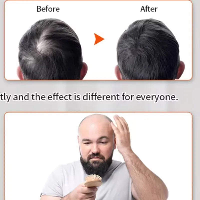 Červená světelná terapie klobouk pro růst vlasů 100 LED korálků pro domácí použití