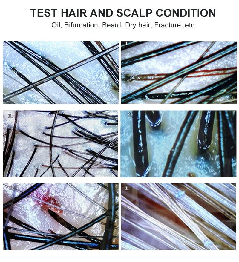 7 Inch Skin Analyzer &ndash; Rechargeable Skin Analysis Tool