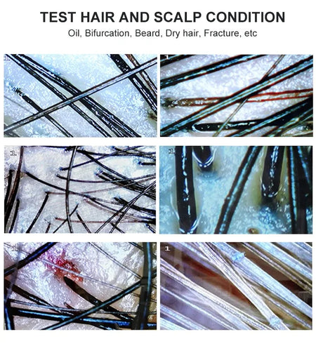 7 Inch Skin Analyzer &ndash; Rechargeable Skin Analysis Tool