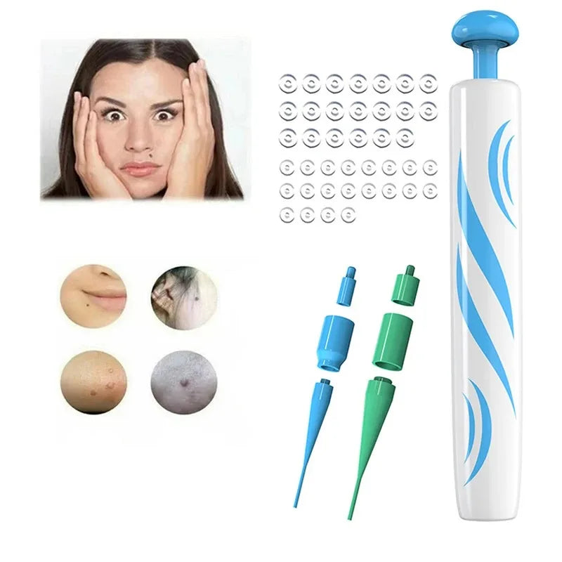 2-In-1 Auto Skin Tag Removal Tool Kit &ndash; Painless Pen