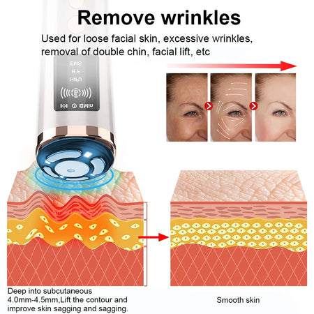 Hifu Face Lifting Facial Massage EMS Facial Microcurrent Skin Rejuvenation Anti-aging Facial Lifting Massager Mini Hifu Machine