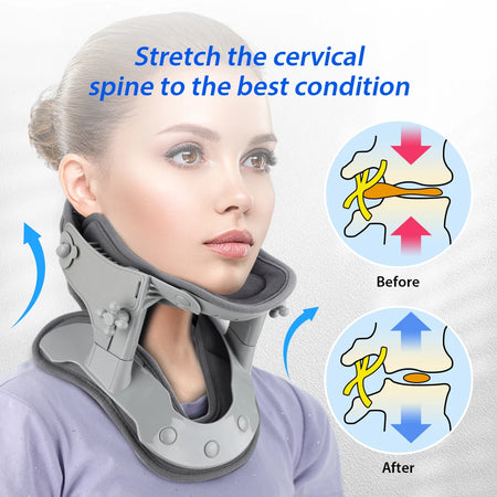 Neck Cervical Traction Apparatus &ndash; Built-in Heating Pads