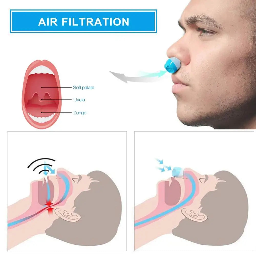 Silicone Nasal Clip Sleep Aid Snore Device &ndash; Ultra-Soft