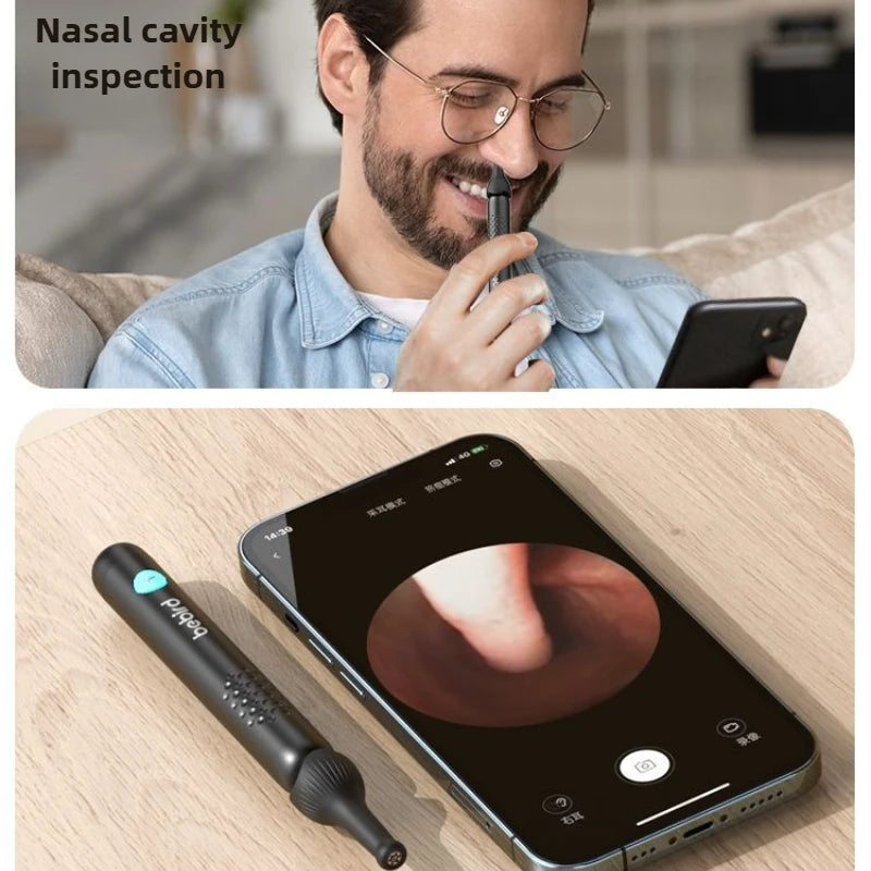 Xiaomi Bebird vizualni čistač ušes z lučmi in kamero HD