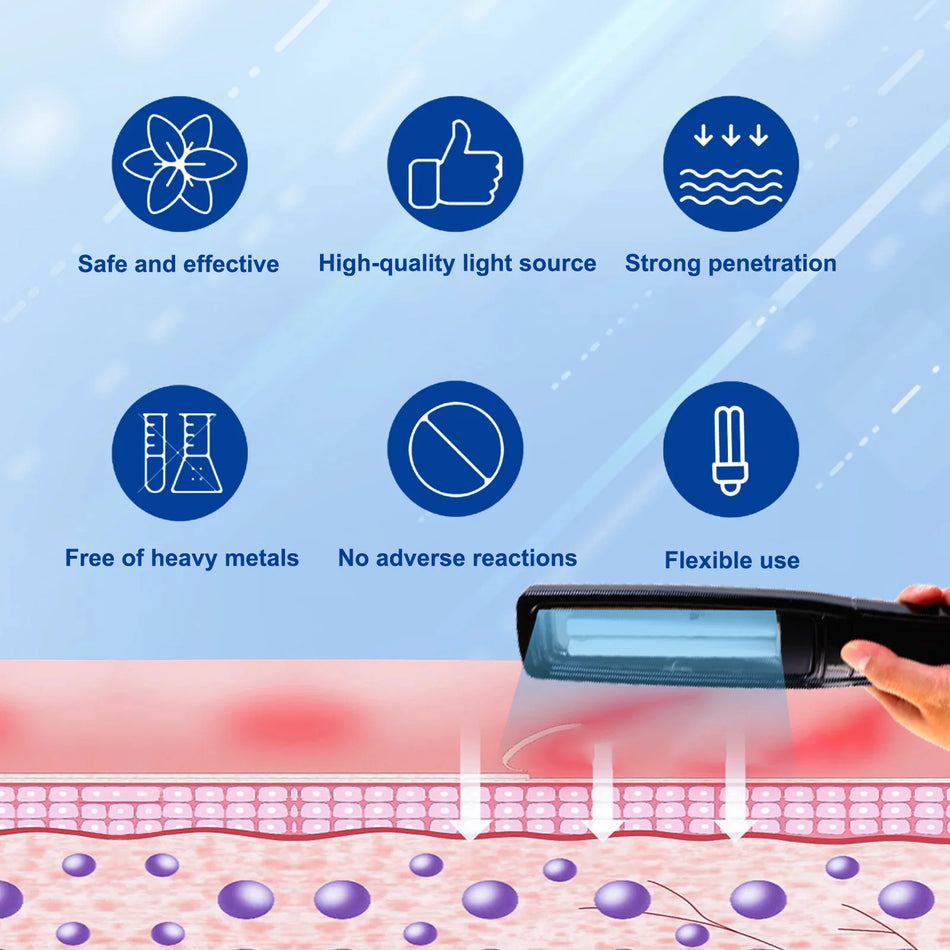 UVB Vitiligo Therapy Light UV311nm Lamp &ndash; Clinical UV Lamp