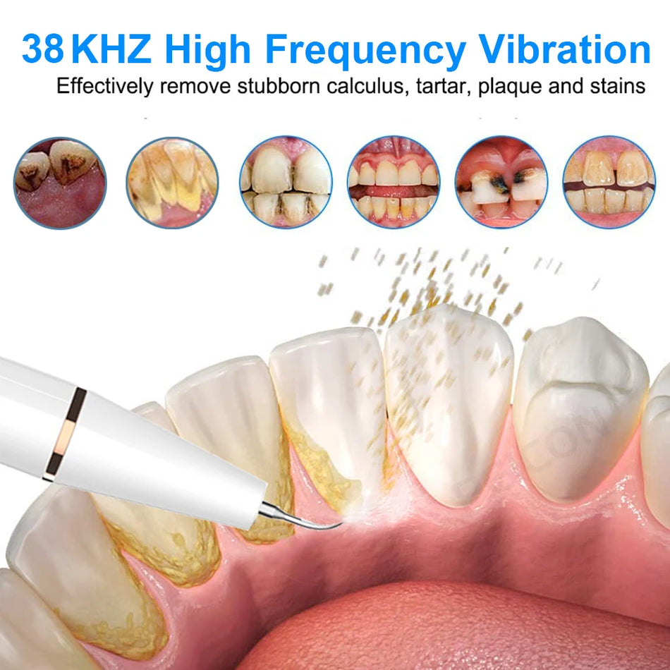 Ultrasonic Dental Scaling Tool for Tartar and Plaque Removal CE Certified