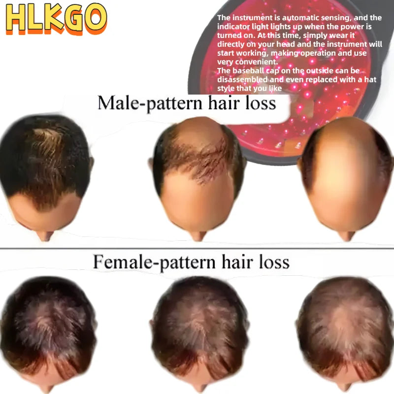 HLKGO 96 Diodi Laser pentru Creșterea Părului Capac LLLT pentru Regenerare