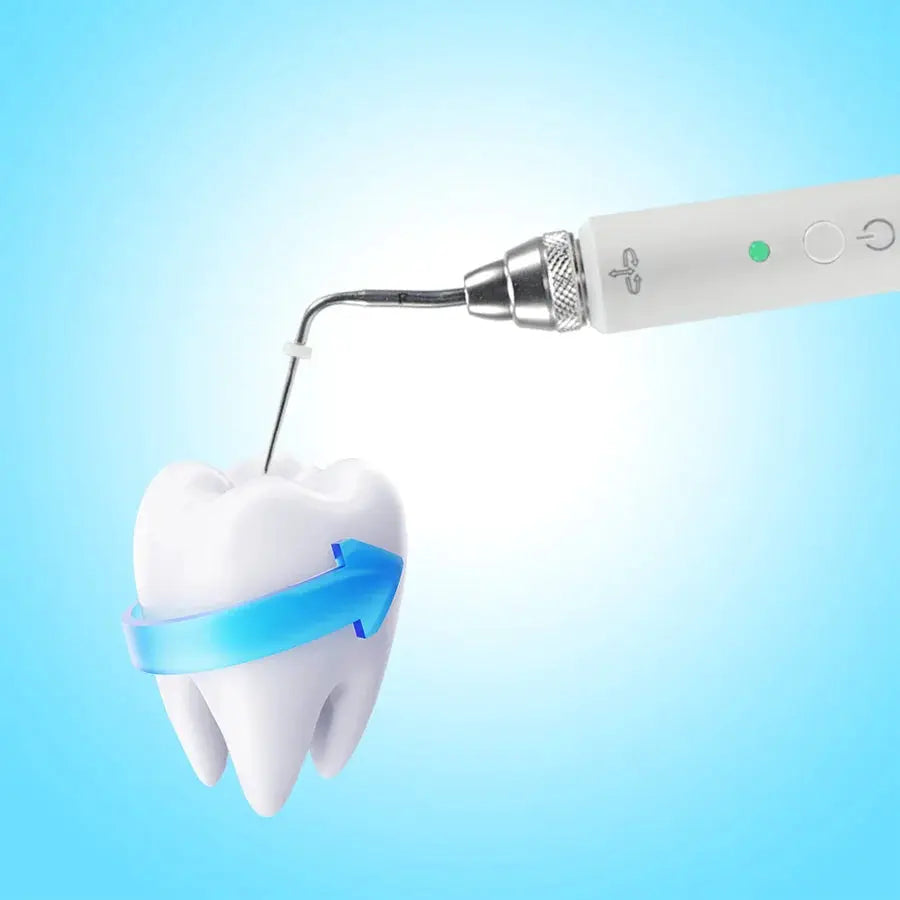 Dental Cordless Gutta Percha Obturation Pen Root Canal Filling System +2 Tips 3 Second Rapid Heating Dental Gutta-percha Cutter by InterCyprus Trading Ltd