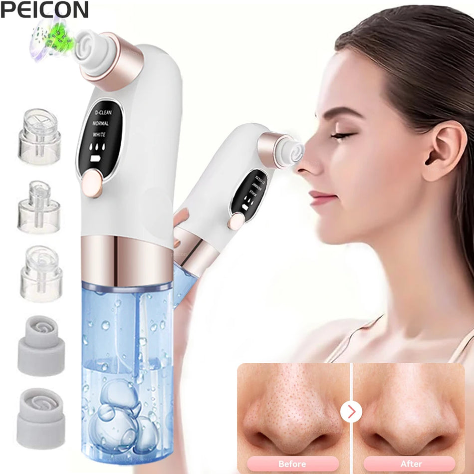 Zwarte Punt Verwijderaar Vacuüm Gezichts Pore Cleaner Voor Acne En Diepe Reiniging