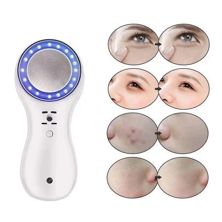 Cold Hammer Blue Light &ndash; Skin Rejuvenation Tightening