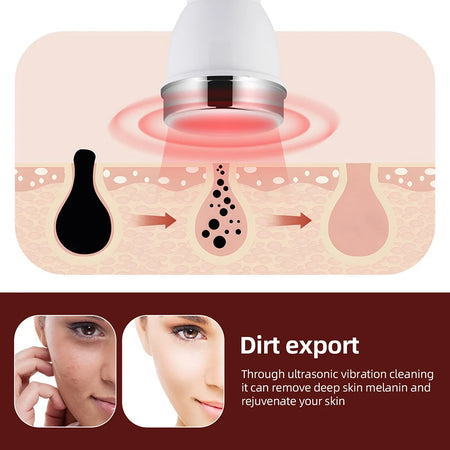 High Frequency Face Eye Massager &ndash; Ultrasound Skin Care Technology