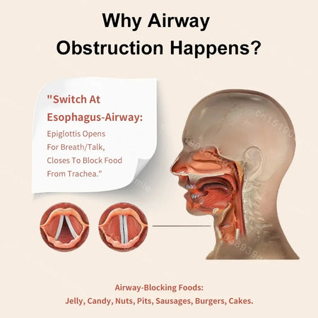 LifVac Choking Rescue Device &ndash; Portable First Aid Kit