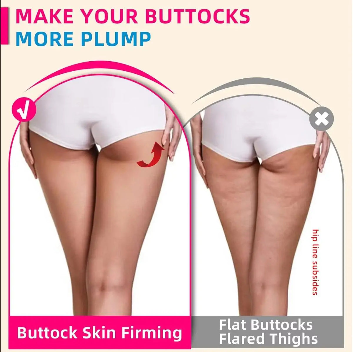 Colombian Buttocks Cups XXL With Y Hose &ndash; Vacuum Therapy