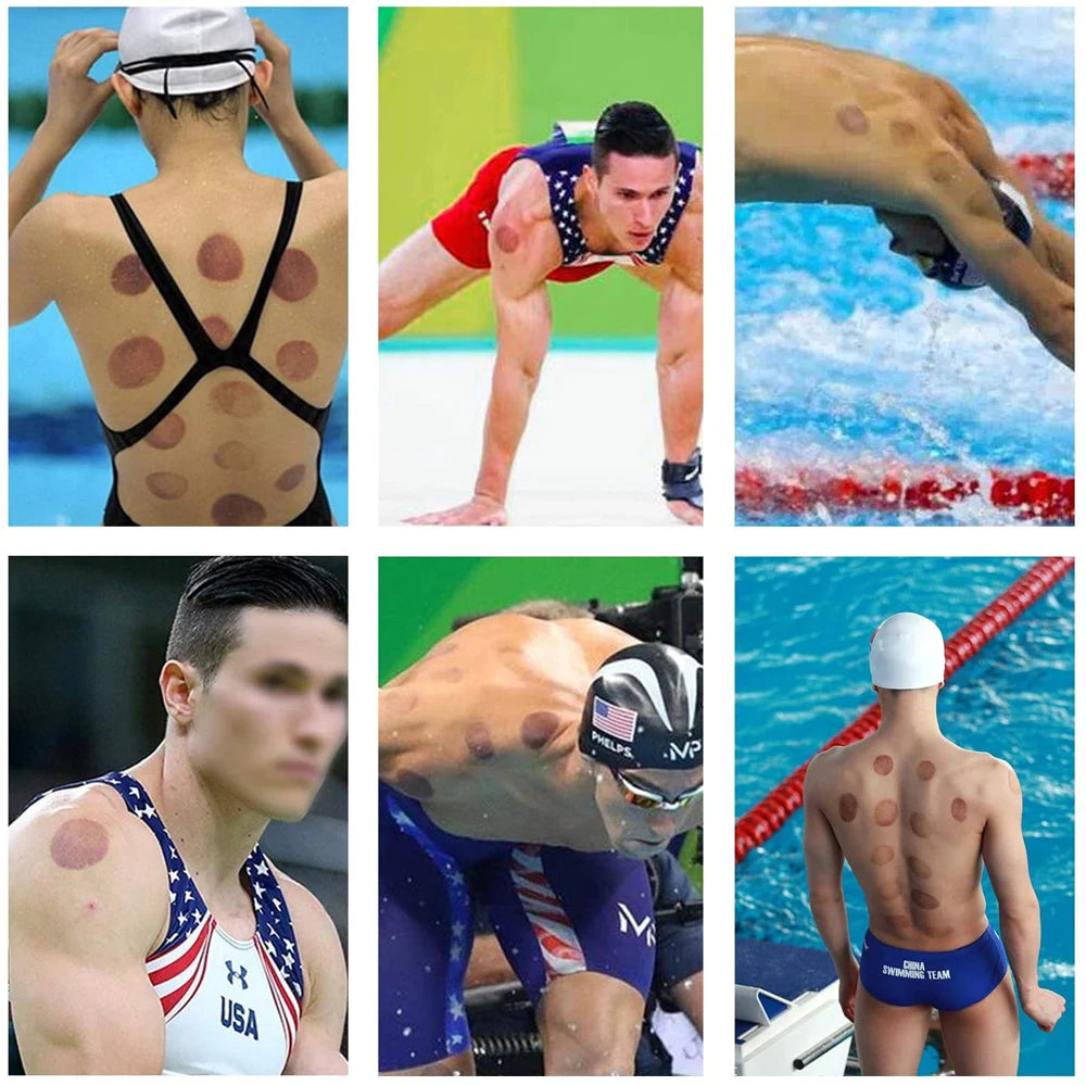 Cupping Therapy Set &ndash; Effective Cellulite Relief and Back Pain Therapy