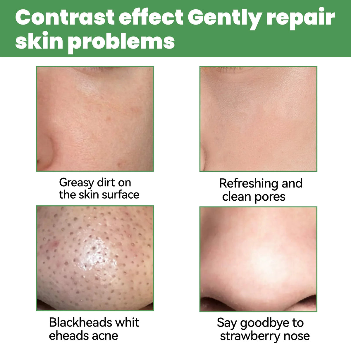 EELHOE Face Cleansing Bubble Mask - Blackhead Remover &amp; Acne Purifying