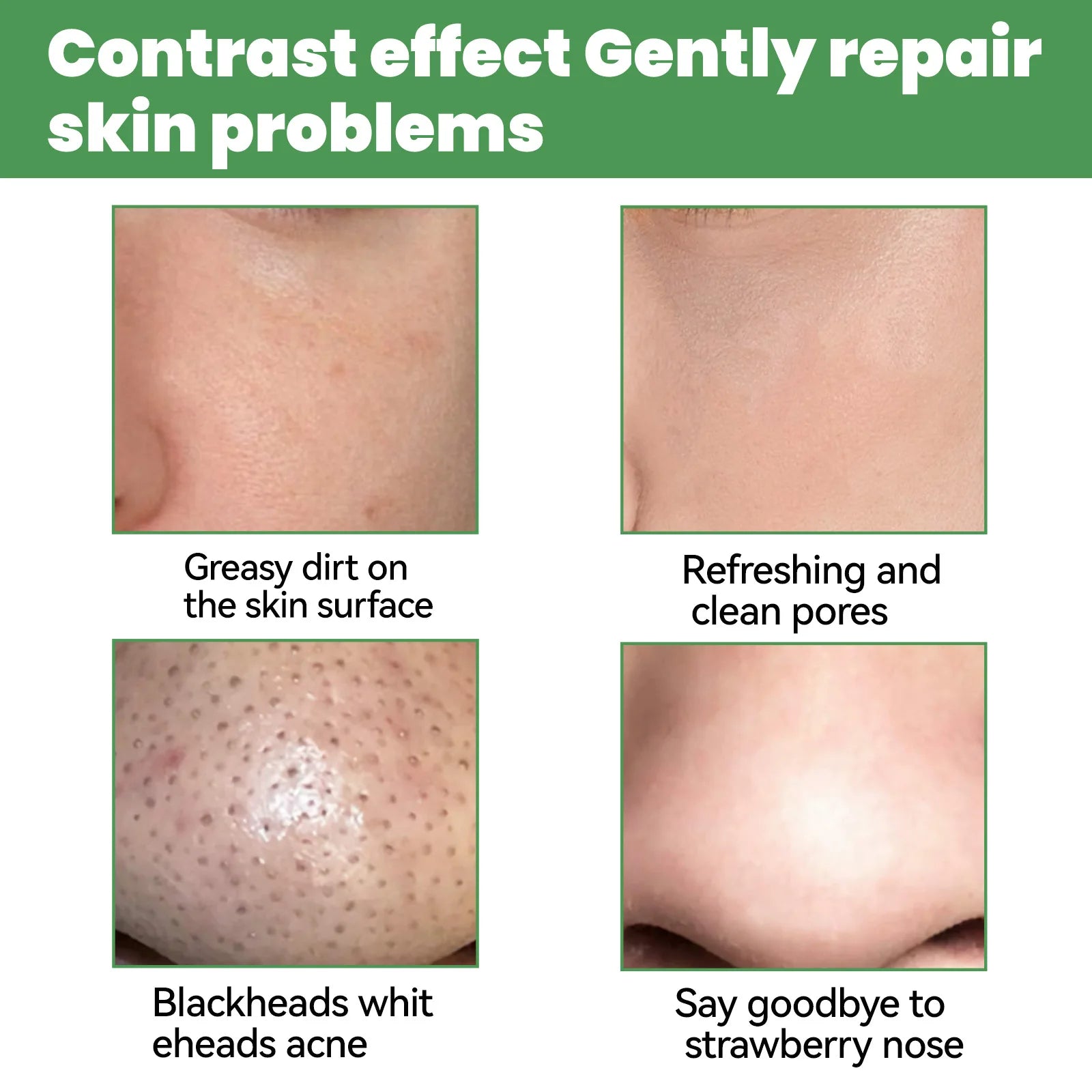 EELHOE Face Cleansing Bubble Mask - Blackhead Remover &amp; Acne Purifying