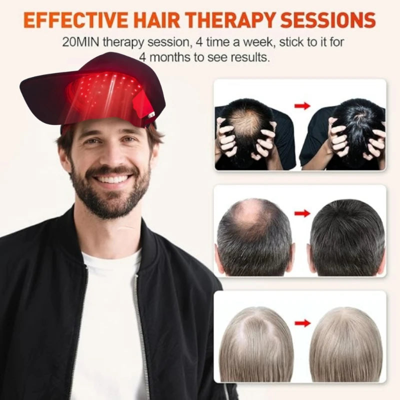 Červená světelná terapie klobouk pro růst vlasů 100 LED korálků pro domácí použití