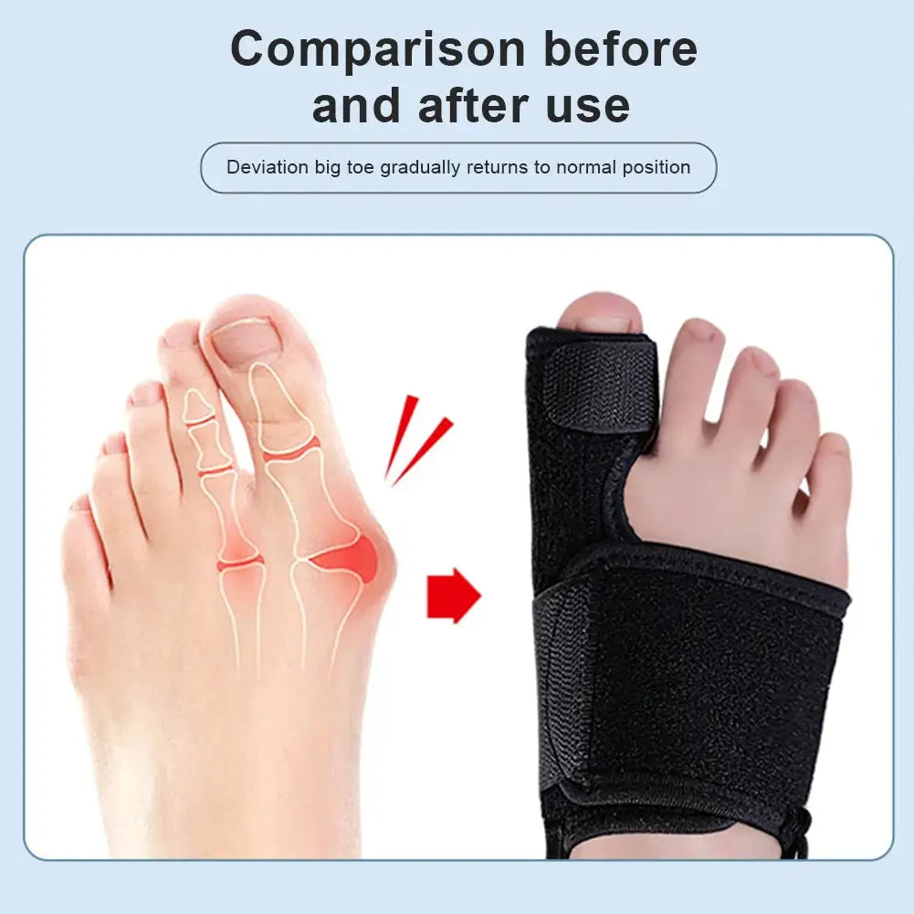 Soft Bunion Corrector Toe Separator With Adjustable Strap