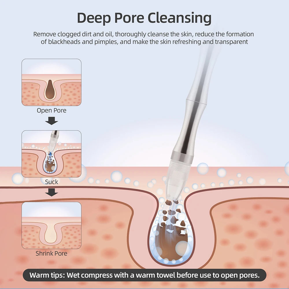 Professional Diamond Microdermabrasion Machine &ndash; Deep Pore Cleaning Exfoliation