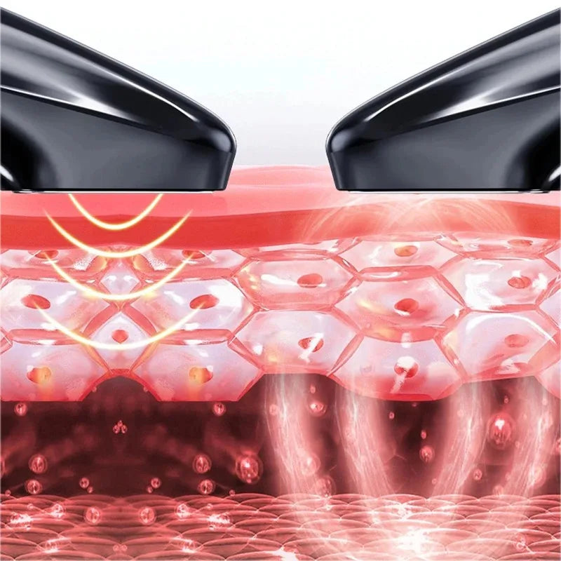 Ozone Cold Plasma Beauty Pen &ndash; Acne Removal Deep Cleaning