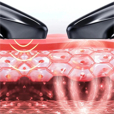 Ozone Cold Plasma Beauty Pen &ndash; Acne Removal Deep Cleaning