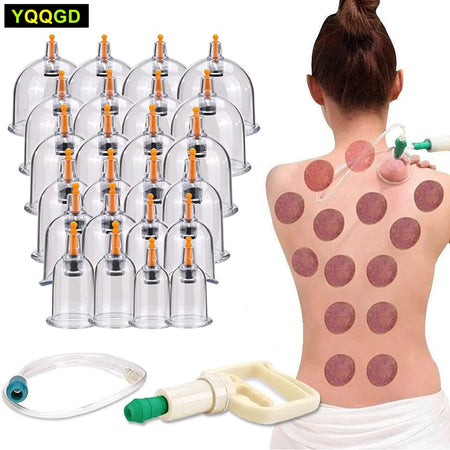 Cupping Therapy Set &ndash; Effective Cellulite Relief and Back Pain Therapy