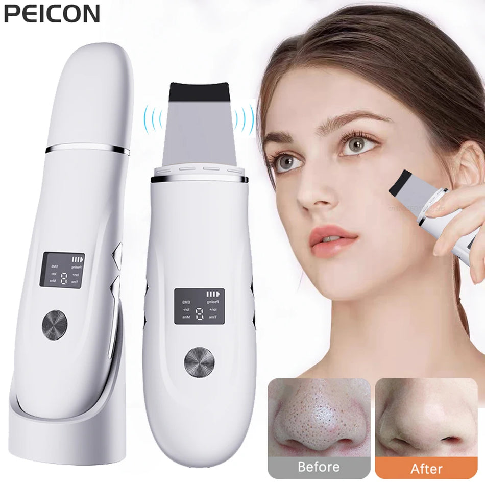 Ultrasonic Skin Scrubber for Blackheads and Pore Cleaning, Facial Tool