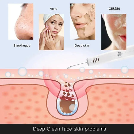 Ultrasonic Facial Scrubber &ndash; Deep Cleansing For Pores