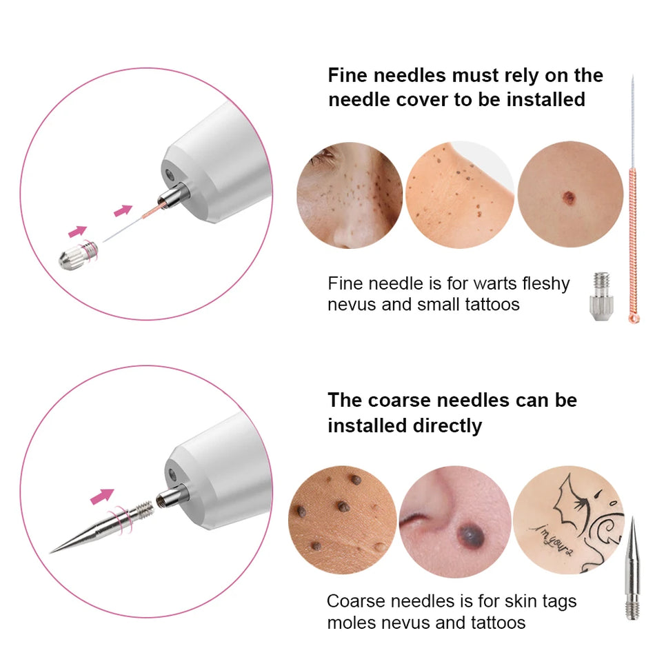 Laser Plasma Pen Needles Set for Dark Spots and Skin Tag Removal